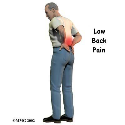 5 giải pháp nhanh và đơn giản đẩy lùi chứng đau lưng