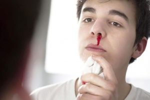 Chảy máu mũi là một trong nguyên nhân dẫn đến hiện tượng chảy máu xuống họng