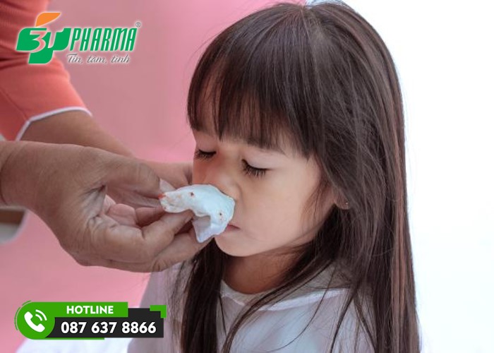 chảy máu mũi một bên là tình trạng phổ biến, nhất là ở trẻ nhỏ - 3T Pharma