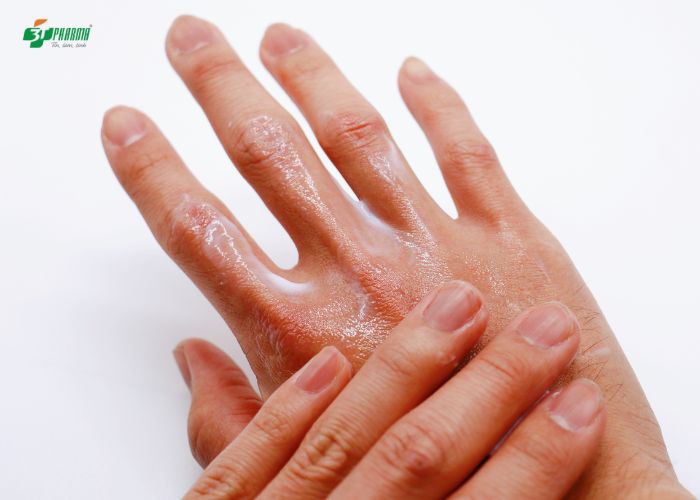 Sử dụng các loại kem dưỡng ẩm da giúp cải thiện da hiệu quả