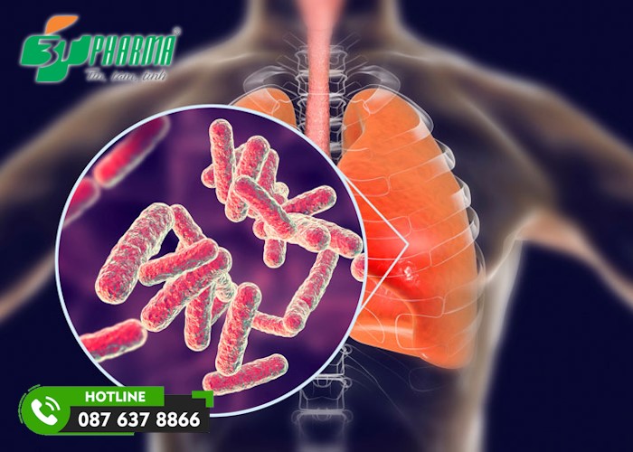 Lao phổi là căn bệnh nguy hiểm vì vi khuẩn lao có thể lây lan và gây bệnh ở các cơ quan khác trong cơ thể - 3T Pharma
